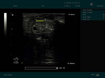EDAN DUS 60 Vet Ultrasound System