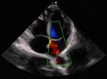 EDAN Acclarix LX9 Diagnostic Ultrasound System