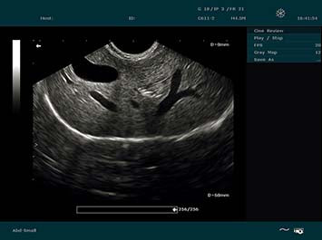 EDAN DUS 60 Vet Ultrasound System