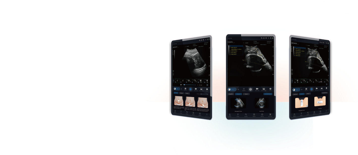 EDAN Acclarix GX9 Intrapartum Ultrasound System
