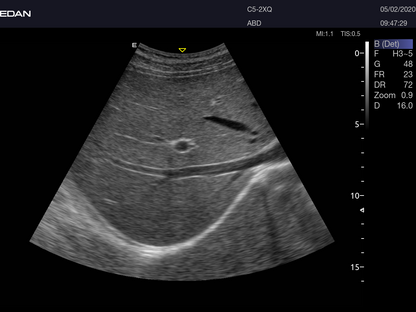 EDAN Acclarix AX8 Diagnostic Ultrasound System