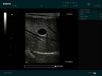 EDAN DUS 60 Vet Ultrasound System