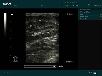 EDAN DUS 60 Vet Ultrasound System