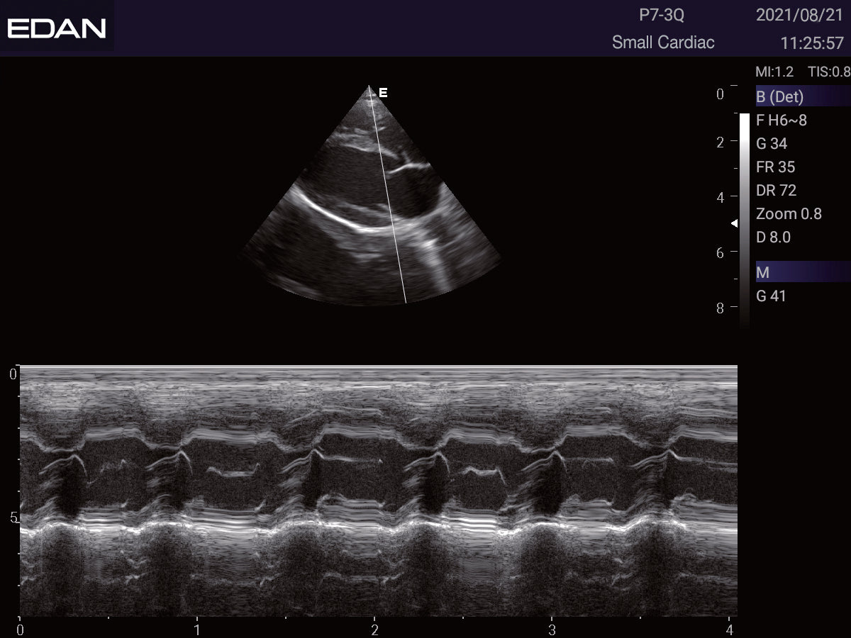 EDAN Acclarix LX3 Vet Ultrasound System