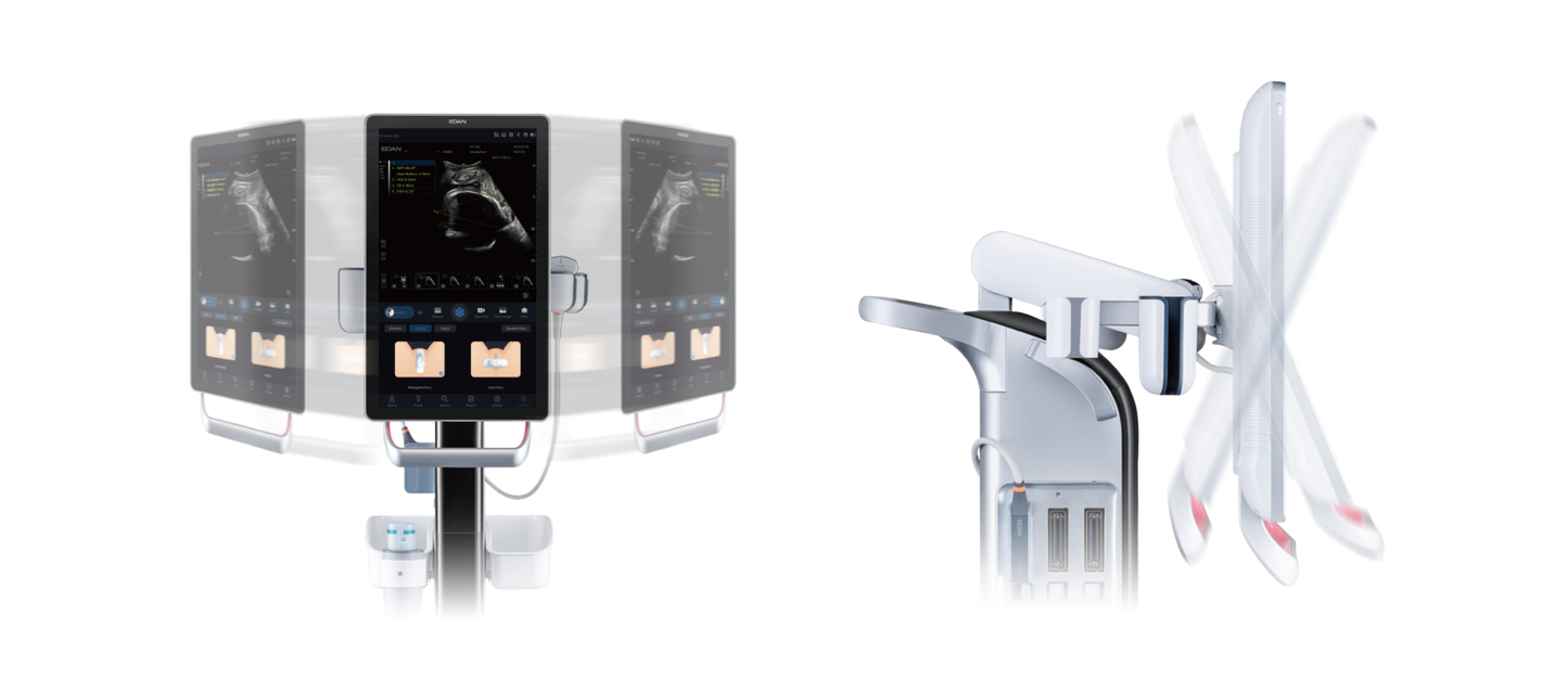 EDAN Acclarix GX9 Intrapartum Ultrasound System