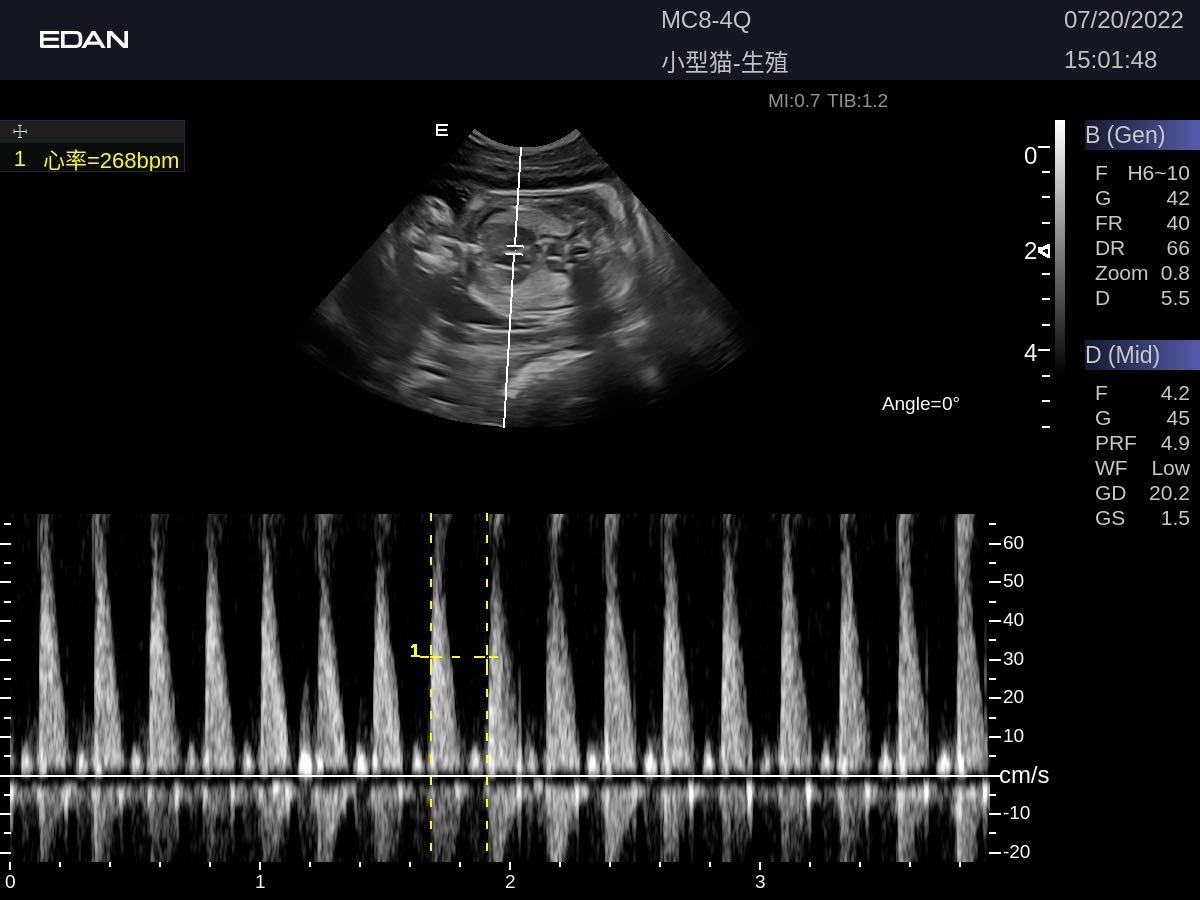 EDAN Acclarix LX9 Vet Ultrasound System