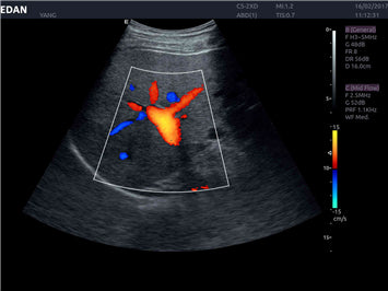 EDAN Acclarix AX8 Diagnostic Ultrasound System