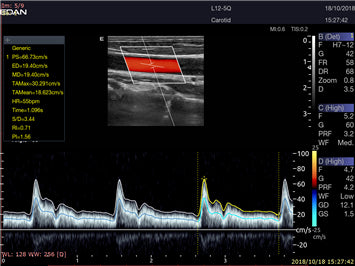 EDAN Acclarix LX9 Diagnostic Ultrasound System