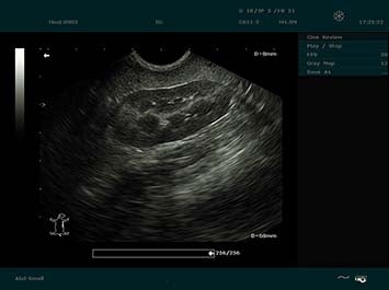 EDAN DUS 60 Vet Ultrasound System