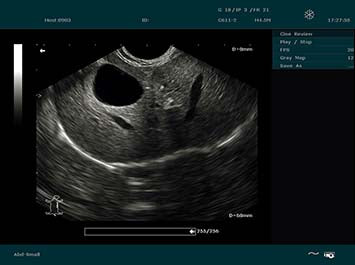 EDAN DUS 60 Vet Ultrasound System