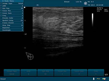 EDAN U2 Diagnostic Ultrasound System