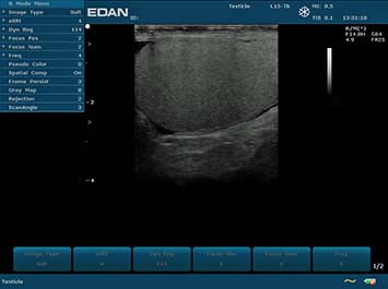 EDAN U2 Diagnostic Ultrasound System