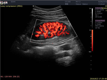 EDAN Acclarix LX9 Diagnostic Ultrasound System