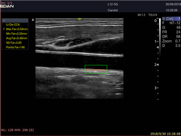EDAN Acclarix LX9 Diagnostic Ultrasound System