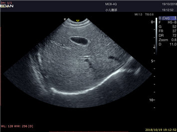 EDAN Acclarix LX9 Diagnostic Ultrasound System