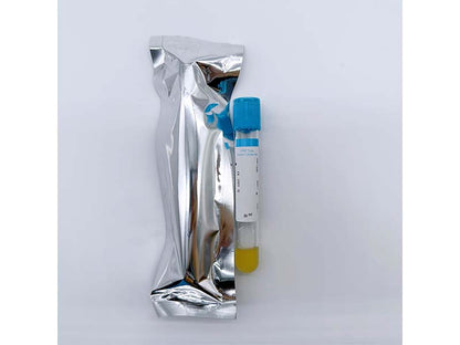 AODEKANG Sodium Citrate Gel Platelet Rich Plasma(PRP) Tube (1)