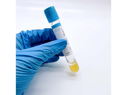 AODEKANG Sodium Citrate Gel Platelet Rich Plasma(PRP) Tube (1)