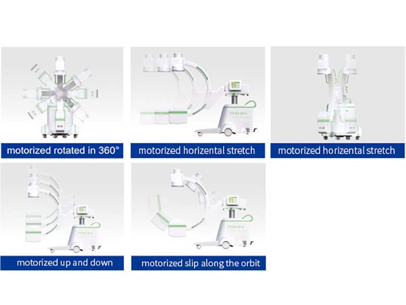 Perlove PLX7000B High Frequency Mobile 12kW C-arm System