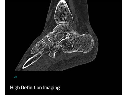 Neusoft NeuViz ACE 64e CT