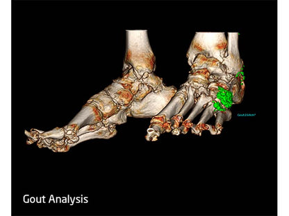 Neusoft NeuViz ACE 64e CT