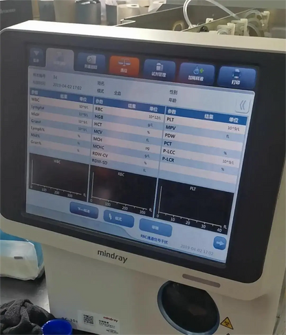 Mindray Used BC-30s 3-Part Hematology Analyzer #