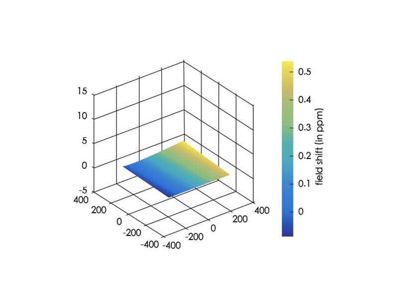 WDM i_Field 1.5T Series Large-aperture Superconductive MRI