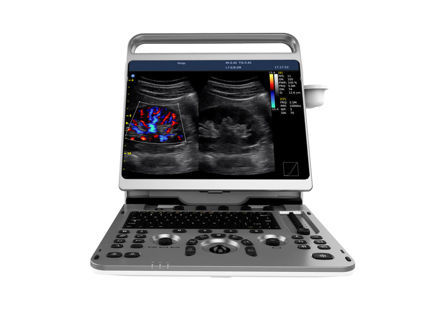 Portable Digital Color Doppler Ultrasound System EBit 50 #