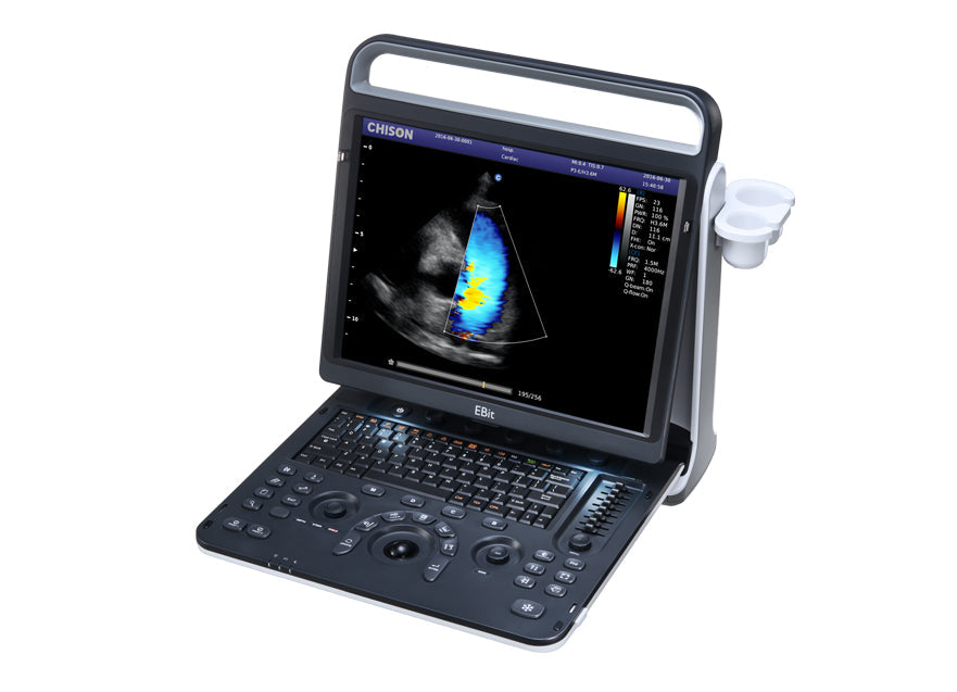 Portable Digital Color Doppler Ultrasound System EBit 60 #