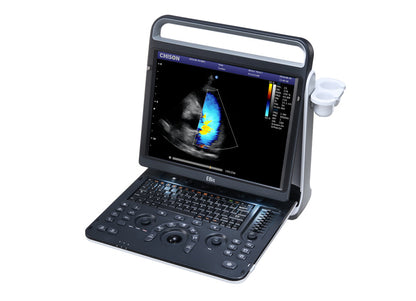 Portable Digital Color Doppler Ultrasound System EBit 60 #