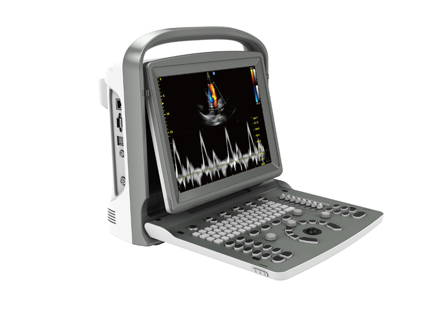 Portable Digital Color Doppler Ultrasound System ECO 6 #