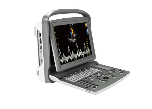 Portable Digital Color Doppler Ultrasound System ECO 6 #