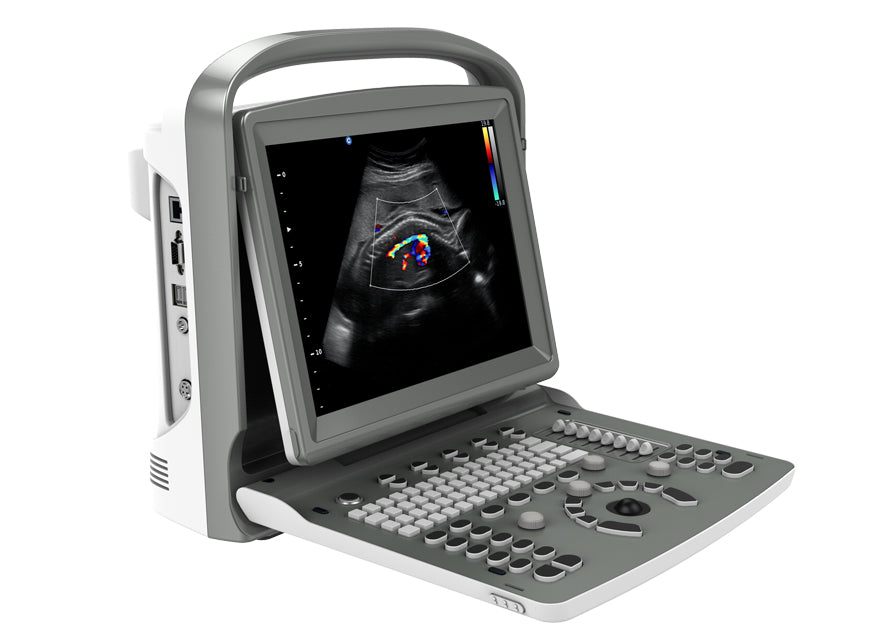 Portable Digital Color Doppler Ultrasound System ECO 6 #