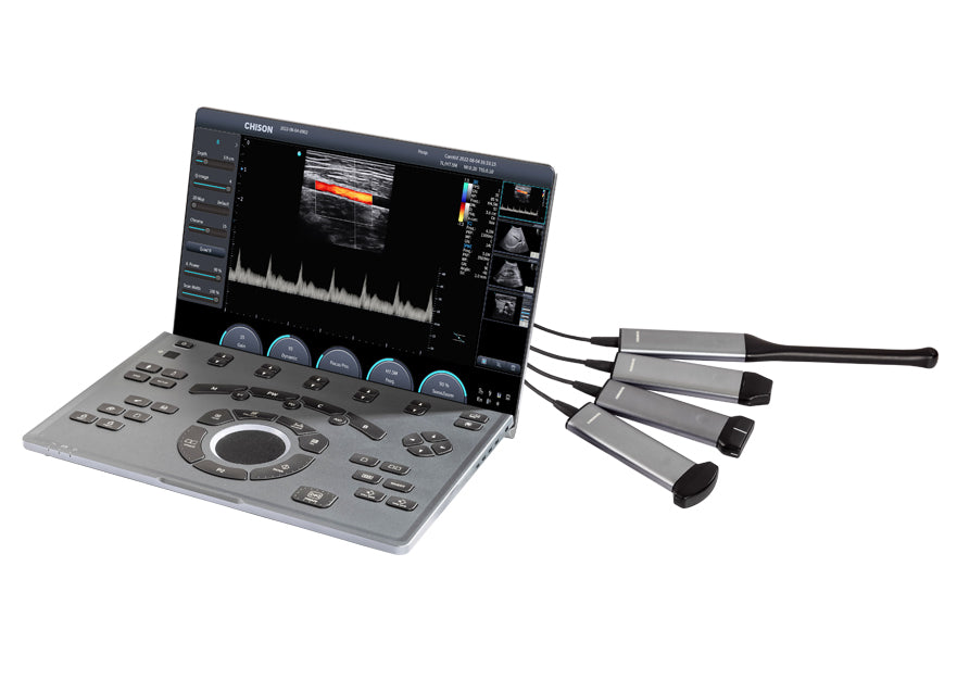 Portable Digital Color Doppler Ultrasound System SonoAir 70 #