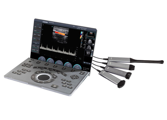 Portable Digital Color Doppler Ultrasound System SonoAir 70 #