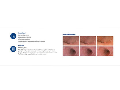 GHM-8000 max High-Definition Video Endoscopy System #