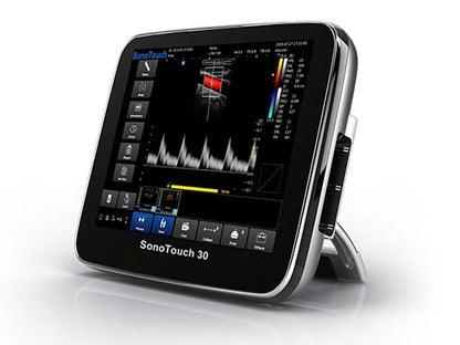 Chison  SonoTouch 30 Portable Color Ultrasound
