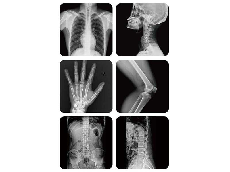 Perlove LD6500 Digital Radiography Floor Mounted Series (1)