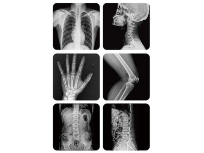 Perlove LD6500 Digital Radiography Floor Mounted Series (1)