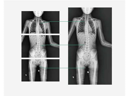 Perlove LD6500 Digital Radiography Floor Mounted Series (1)