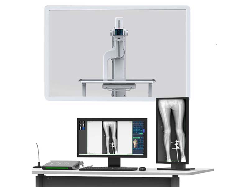 Perlove PLX8600 High Frequency Digital RadiographyFluoroscopy System (1)