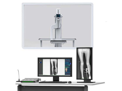 Perlove PLX8600 High Frequency Digital RadiographyFluoroscopy System (1)