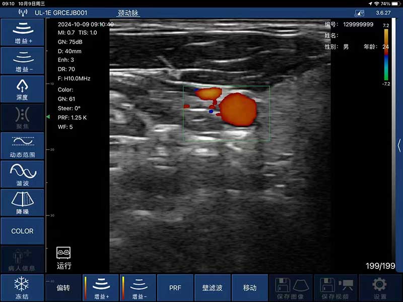 Global Healthcare Medical interchangeable-probe palm Doppler ultrasound scanner with magnetic probe connection for point-of-care imaging