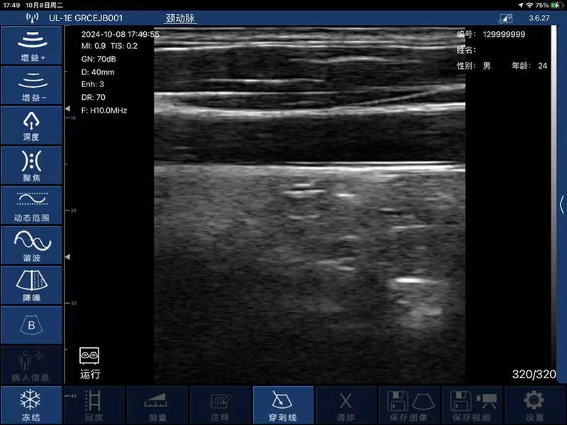 Global Healthcare Medical interchangeable-probe palm Doppler ultrasound scanner with magnetic probe connection for point-of-care imaging
