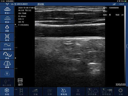 Global Healthcare Medical interchangeable-probe palm Doppler ultrasound scanner with magnetic probe connection for point-of-care imaging