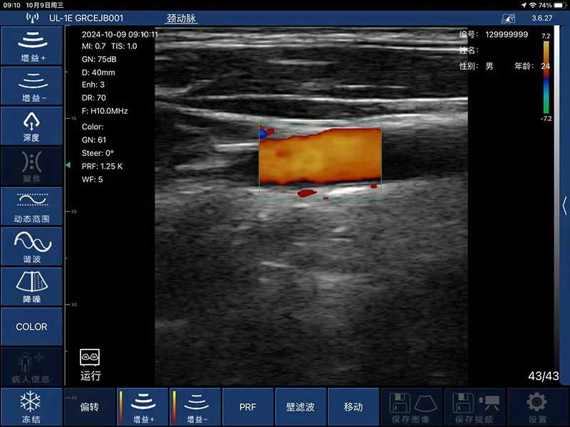 Global Healthcare Medical interchangeable-probe palm Doppler ultrasound scanner with magnetic probe connection for point-of-care imaging