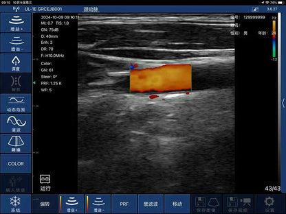 Global Healthcare Medical interchangeable-probe palm Doppler ultrasound scanner with magnetic probe connection for point-of-care imaging