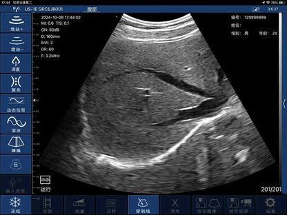 Global Healthcare Medical interchangeable-probe palm Doppler ultrasound scanner with magnetic probe connection for point-of-care imaging