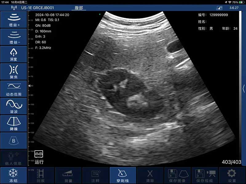 Global Healthcare Medical interchangeable-probe palm Doppler ultrasound scanner with magnetic probe connection for point-of-care imaging