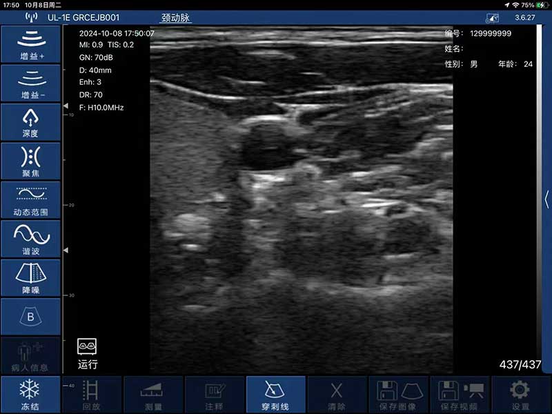 Global Healthcare Medical interchangeable-probe palm Doppler ultrasound scanner with magnetic probe connection for point-of-care imaging
