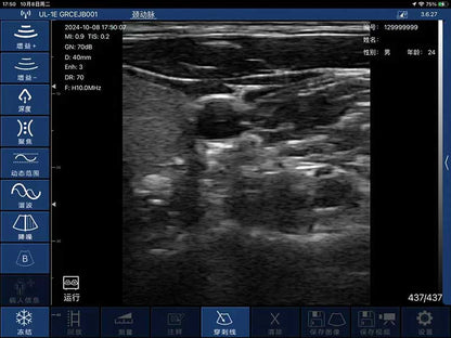 Global Healthcare Medical interchangeable-probe palm Doppler ultrasound scanner with magnetic probe connection for point-of-care imaging